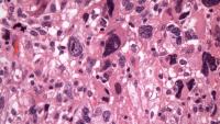 Pleomorphic area 40x